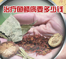 治疗鱼鳞病要多少钱